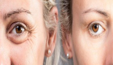 botox artikel