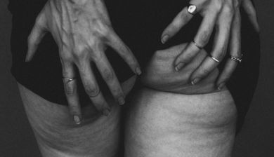 cellulitis artikel
