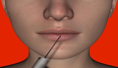 injectables artikel